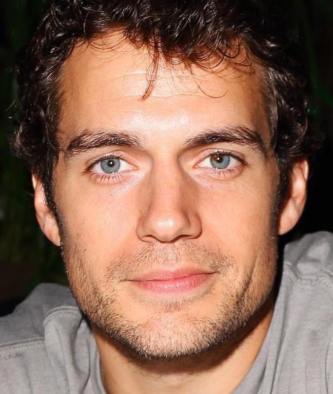 Henry Cavill Eye Condition