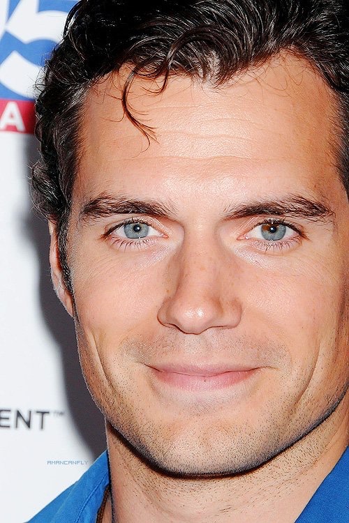Henry Cavill Eye Condition
