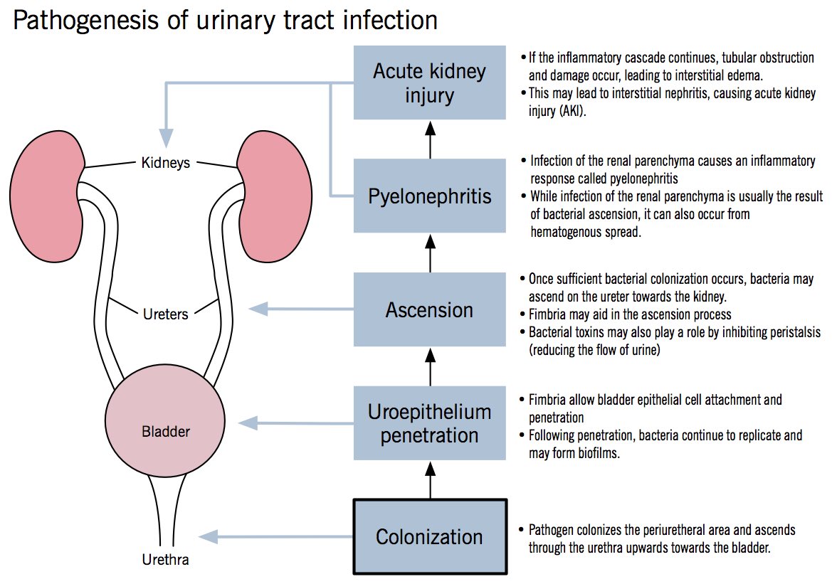 UTI (urethra, and bladder) ascends to kidneys in usual pyelonephritis - Neutrophils, microbes 🦠 infiltrate renal interstitium. This will affect cortex of kidney, but will spare glomeruli/vessels. 

Chronic inflammation can damage renal tissues and obstruct fluid flow as well.