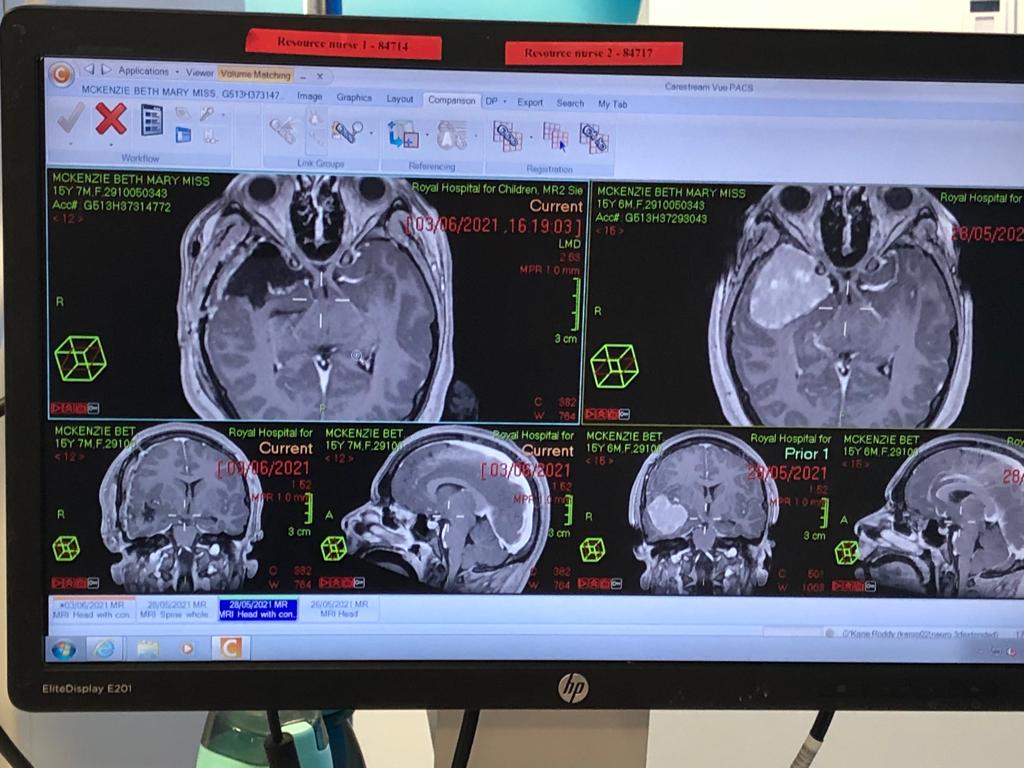 RHCGlasgow's tweet photo. Beth underwent brain sugery to remove a tumour the siz of an orange 

The 16 year old wrote a note to Roddy, her brain surgeon, to say thanks for everything he had done, even if it didn't go well 

10 monts on, Beth is now sitting her highers... 

https://t.co/4PQCljFYB4 

#RHCG https://t.co/Wmey7Hjk3a