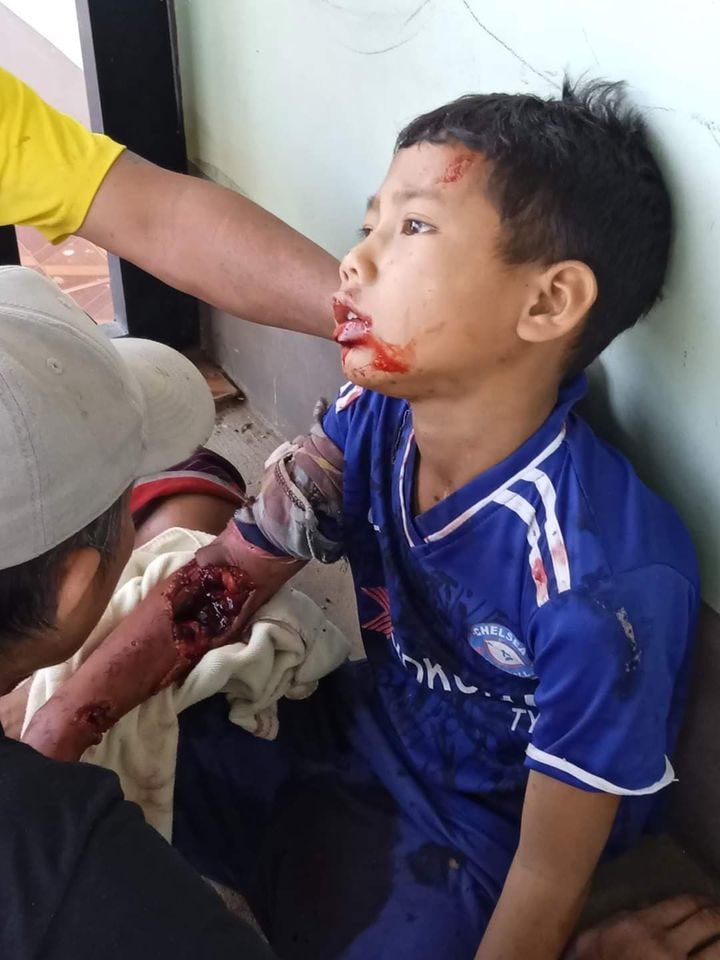 2 children got injured following a bomb blast in Dawoukhu ward, Loikaw tsp at about 10 am this morning, according to the locals.  #BURMAAct2021 #PressureCongress #2022Apr4Coup #HearTheVoiceOfMyanmar