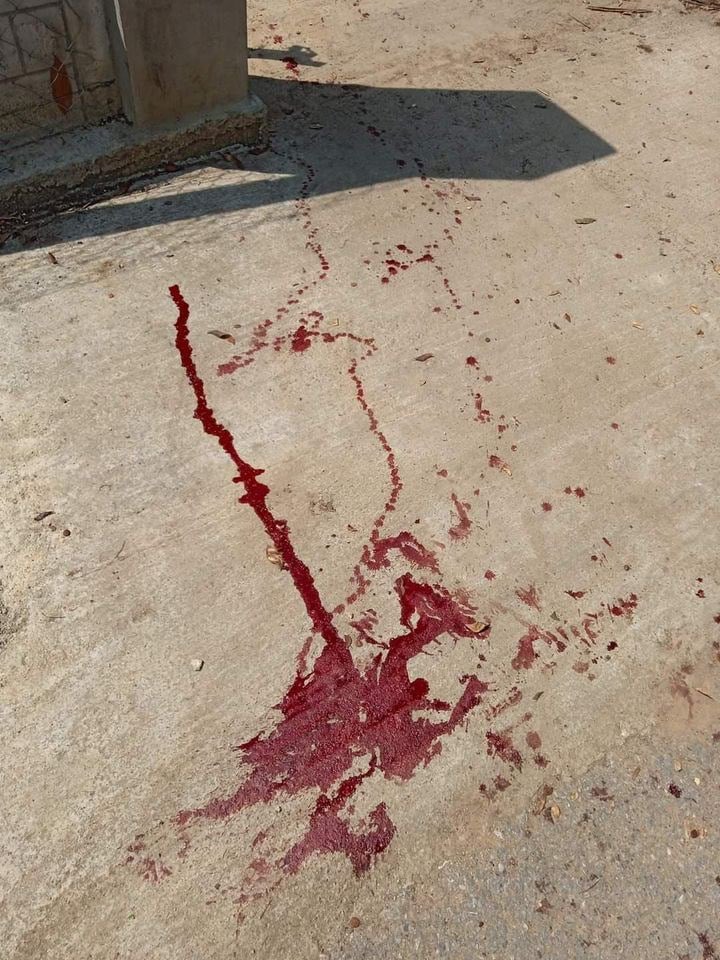 mtina2613's tweet photo. 2 children got injured following a bomb blast in Dawoukhu ward, Loikaw tsp at about 10 am this morning, according to the locals.  #BURMAAct2021 #PressureCongress #2022Apr4Coup #HearTheVoiceOfMyanmar https://t.co/luuC0j4fxD
