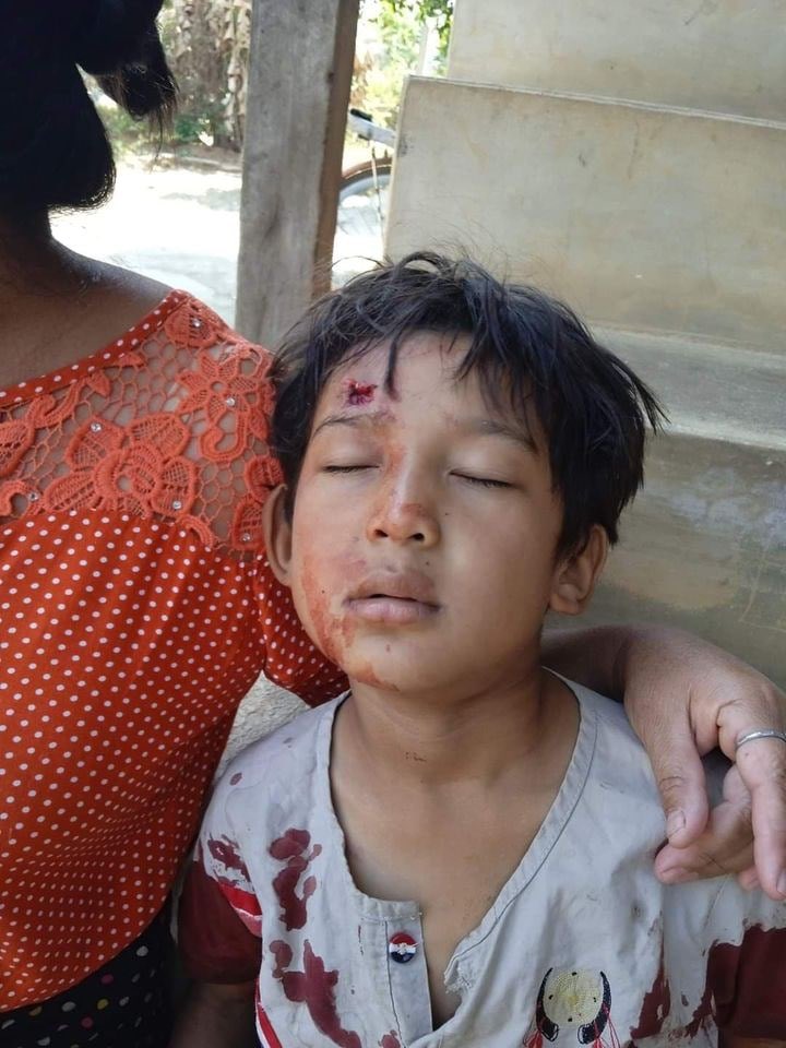 mtina2613's tweet photo. 2 children got injured following a bomb blast in Dawoukhu ward, Loikaw tsp at about 10 am this morning, according to the locals.  #BURMAAct2021 #PressureCongress #2022Apr4Coup #HearTheVoiceOfMyanmar https://t.co/luuC0j4fxD