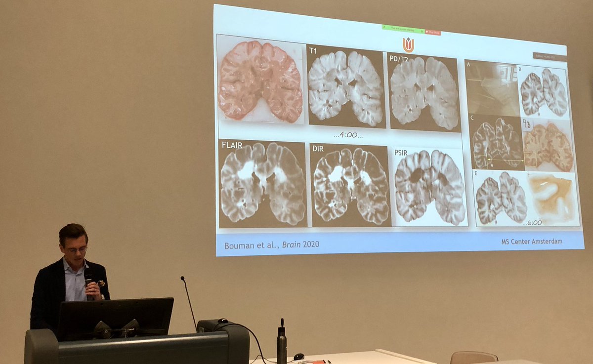 NeuroLaura's tweet photo. PhD student Piet Bouman presenting four years of his work on multiple sclerosis cortical lesion during the departmental meeting, great work and a very nice overview! #PhDalmostDone https://t.co/L9aOO4qikU