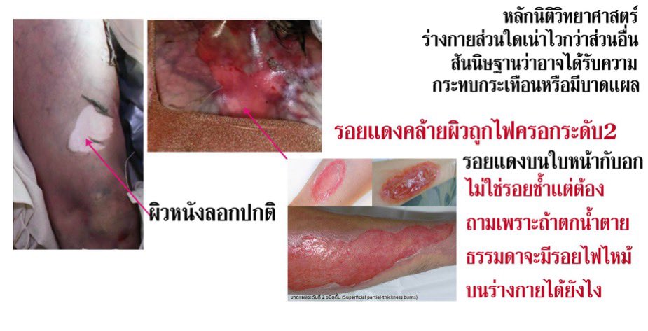 benau1234's tweet photo. Burn again ??? 😡 #แตงโมต้องได้รับความเป็นธรรม https://t.co/8yROYb8fRT