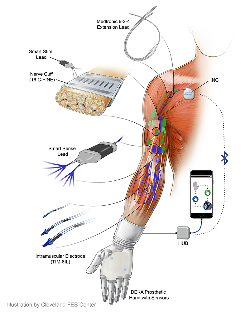 DARPA's tweet image. Imagine losing your hand, but regaining the sense of touch years later via #sensorized #prosthetic.  DARPA’s newest podcast explores the #HAPTIX program w/experts and a patient from @ClevelandVAMC. Listen at: darpa.mil/about-us/podca…. This is one you won’t want to miss!
