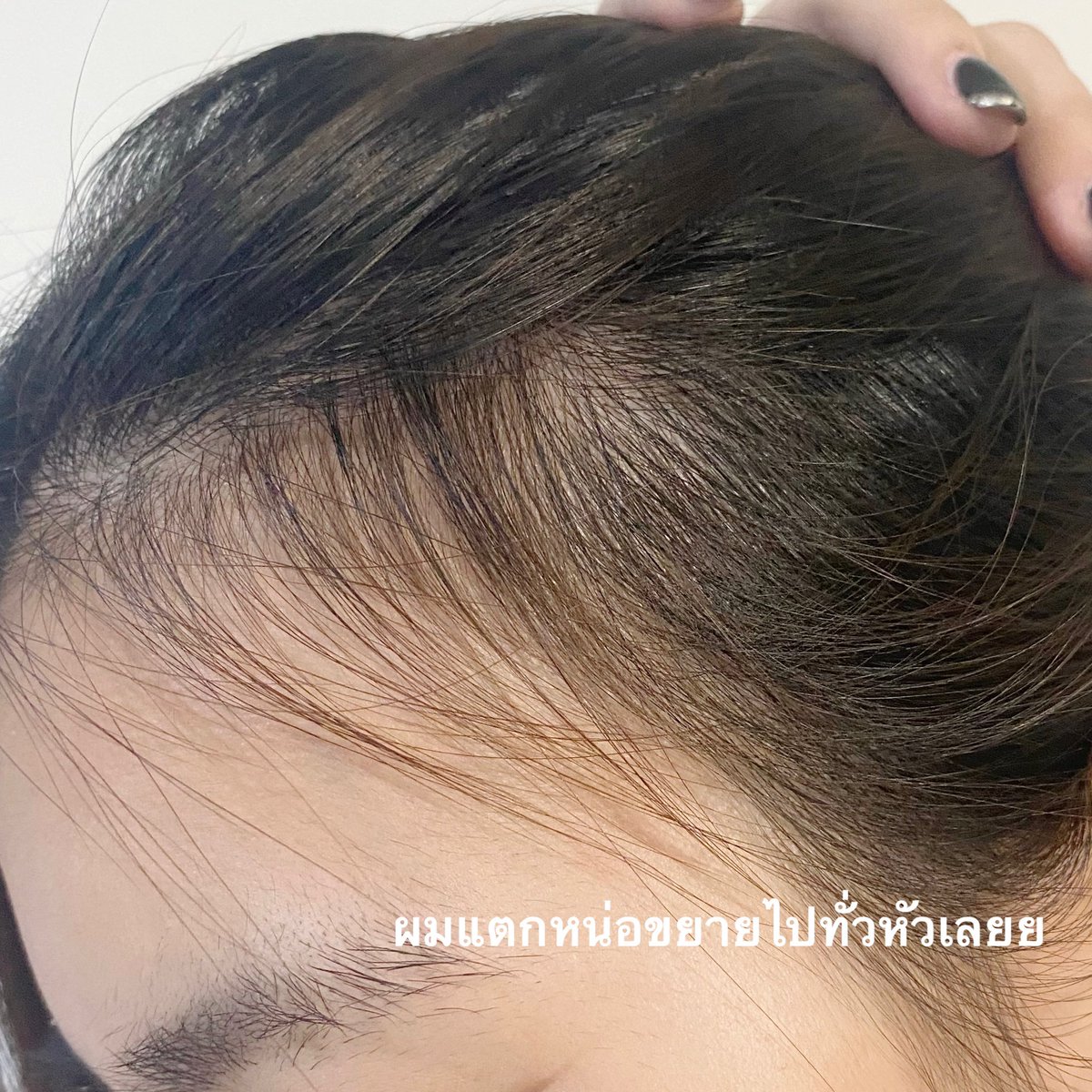 มนุษย์สำอาง tweet media