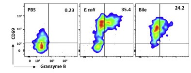 AJPathology's tweet image. Bile from Patients with #PrimarySclerosingCholangitis Contains Mucosal-Associated Invariant T Cell Antigens. From authors @Oslounivsykehus, @UniOslo, and @karolinskainst. FREE to all readers: ajp.amjpathol.org/article/S0002-… #liverdisease