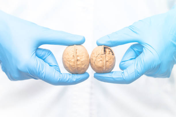 ReproMed_SMRU's tweet photo. April is #TesticularCancerAwarenessMonth. Testis cancer is most common in men ages 20-35. and is curable when caught early! Risk factors include a history of #undescended testis and #maleinfertility. Self exam is an easy way to screen. Seek a professional if you have concerns! https://t.co/bbgspnnFss