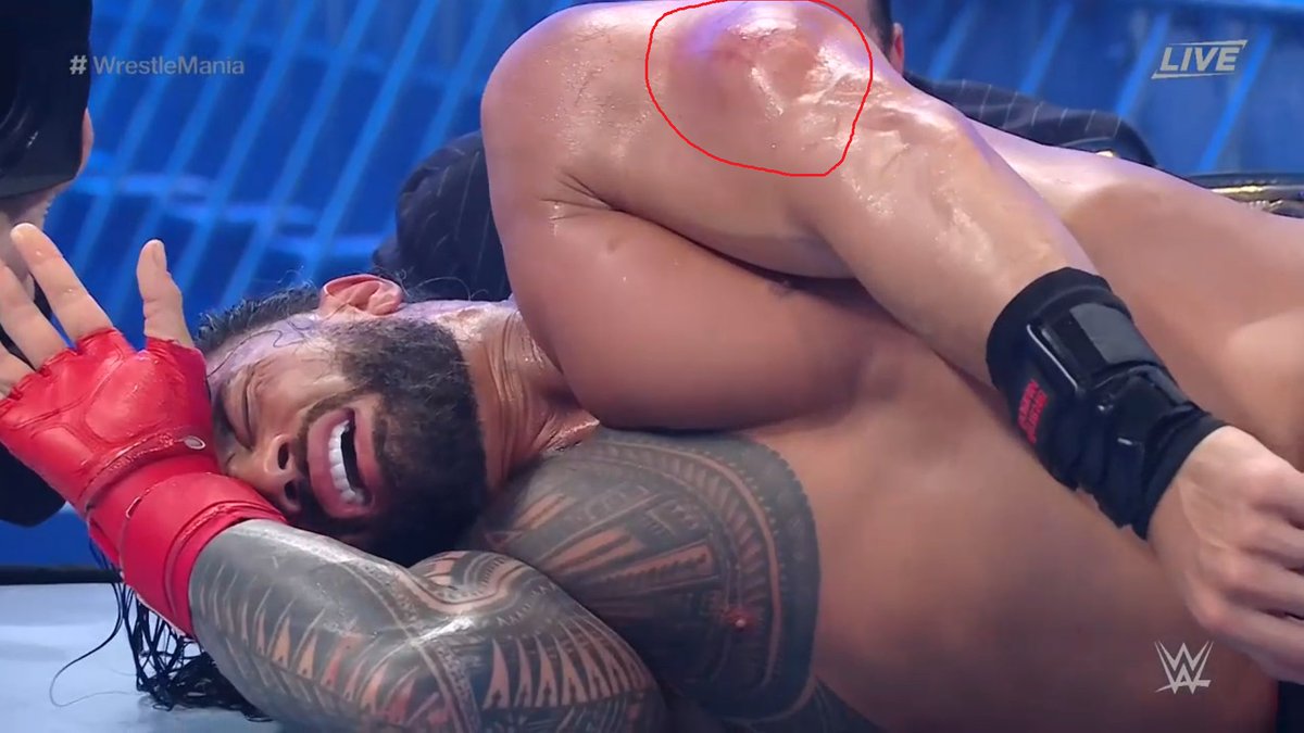 ZueraOfWrestlin's tweet photo. O final do evento principal teria sido afetado por uma possível lesão do Roman https://t.co/BmEUBucK6l