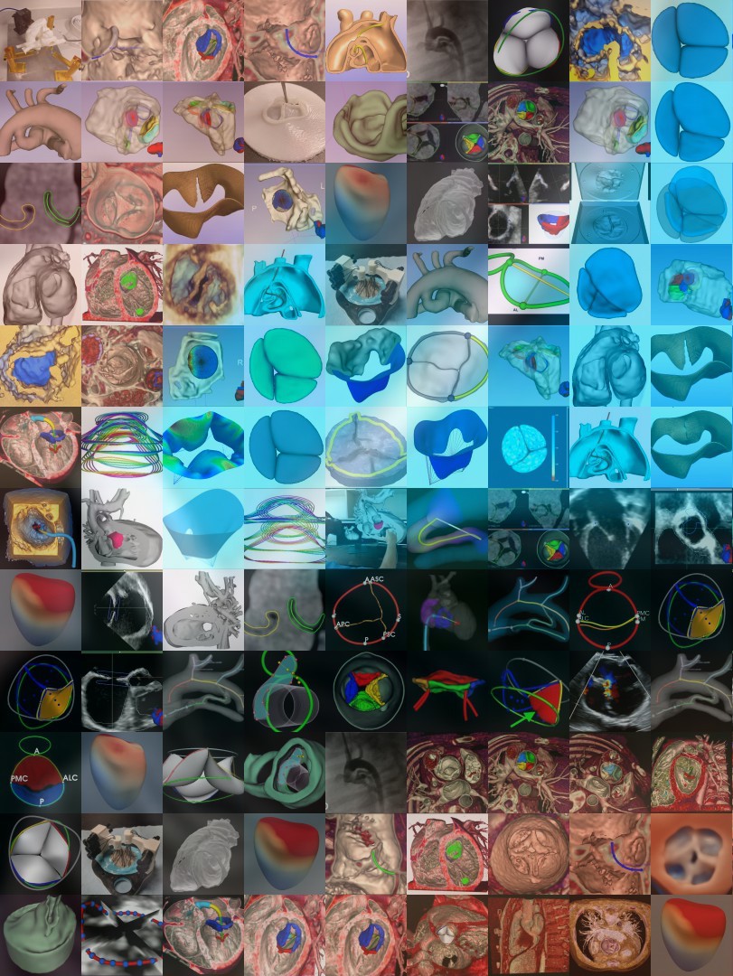 JolleyLab's tweet photo. 'The Big Picture of Pediatric Cardiac Research' is comprised of hundreds of images showcasing the Jolley Lab's research in patient-specific modeling and analysis, demonstrating the integration of Alana's passion for art, science, and medicine. @3DSlicerApp #SlicerHeart https://t.co/pTuodKOeoW