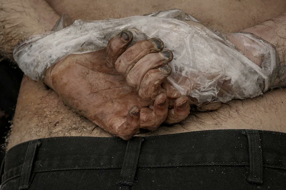 Buche, Ukraine, Sunday, April3, 2022: black fingernails of corpse, one of atleast hundreds left in barrels, basements, sidewalks; strangled, halfnaked, hands tied; tortured, raped, mass-murdered by Putin, Russian Regime soldiers given awards, monetary rewards, & national praise in Russia for doing so: genocide; as EU is forced to buy even more expensive oil, gas, yet continue to try to sanction, punish, prevent, stop this unprovoked egregious war, which traumatises all of us seeing it that can do nothing to stop it, but protest against it. #нетвойне 