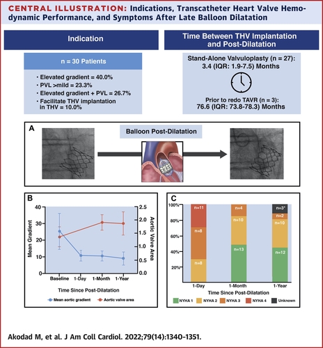 Late balloon dilatation late after TAVI appears feasible and safe in appropriately selected patients and may result in THV frame expansion resulting in improvements in hemodynamic performance and PVL
From @jaccjournals jacc.org/doi/10.1016/j.…