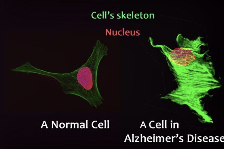 NeuroRedoxin's tweet image. Come work with me! Looking for a graduate student with interest in Neurobiology of Neurodegeneration. We won’t left any organelle unturned until we find out the cause of cell death!