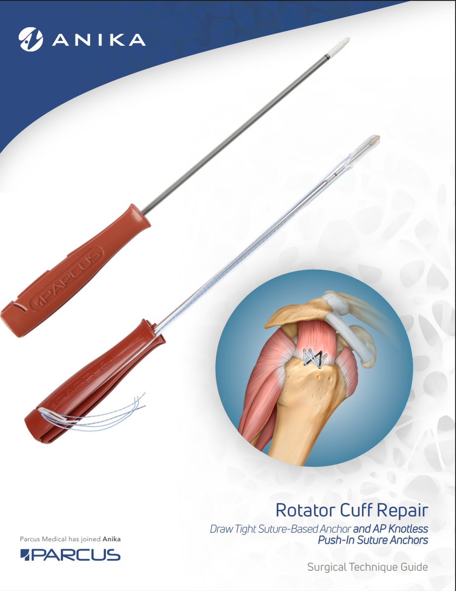 One of many RCR configurations utilising the Draw Tight Suture-Based Anchor and AP Knotless Push-In Suture Anchors for double row rotator cuff repair. anika.com/wp-content/upl… #AnikaSportsMedicine #RCR #Softtissuerepair