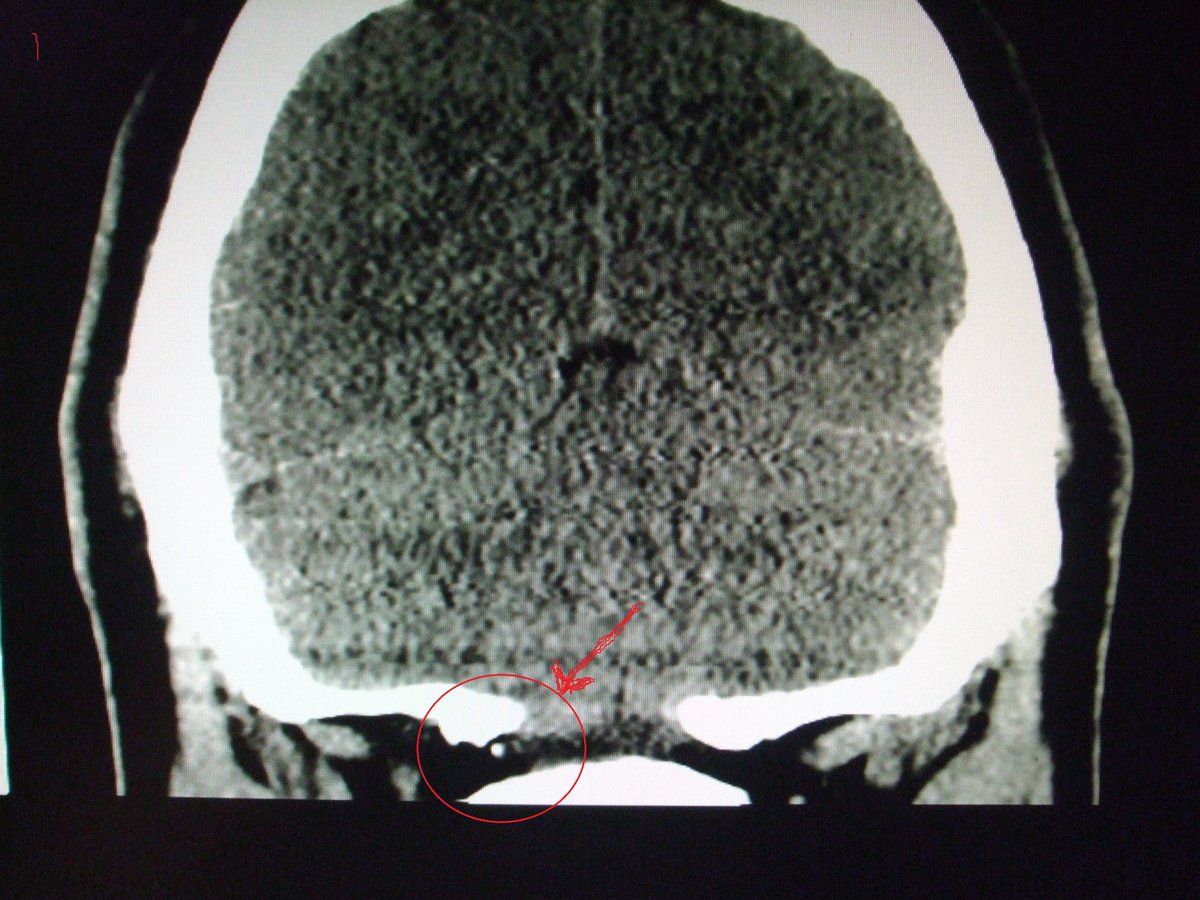 wheeloffreedom1's tweet photo. I have to wonder if #CCPHollywood is also involved in torturing me?
or
Maybe it's just the #Rolfes using their #RapeChip... 
#Rape to them is just a way of life...
Cousin Danny doesn't even try to hide his mocking of me on his profile.. #BioChip in head
Was I #Raped by a midget? https://t.co/iFpkj0bjax