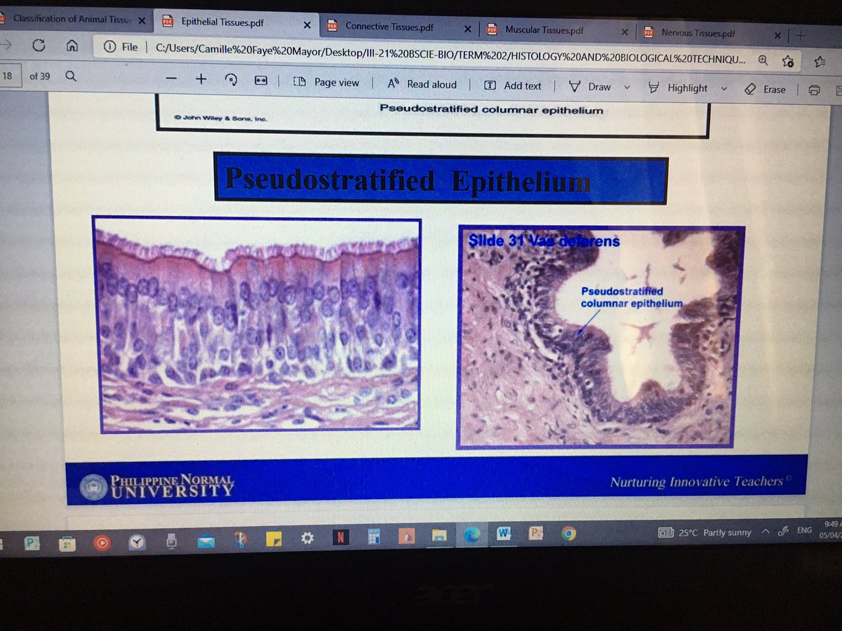 missFAYEth's tweet photo. Pasado sa exam cutieeee✨✨✨

Honestly sobrang kulang pa ko sa review😌 but I trust my braincells, you can do it guys.

#Histology https://t.co/OdiMO7vkbn
