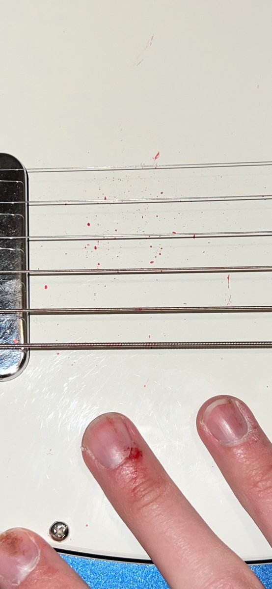 musicbyjsolomon's tweet photo. y’all i finally did it, i bled on my guitar at a show. feeling like a real #indierocker https://t.co/DWZ7Ot3KBB