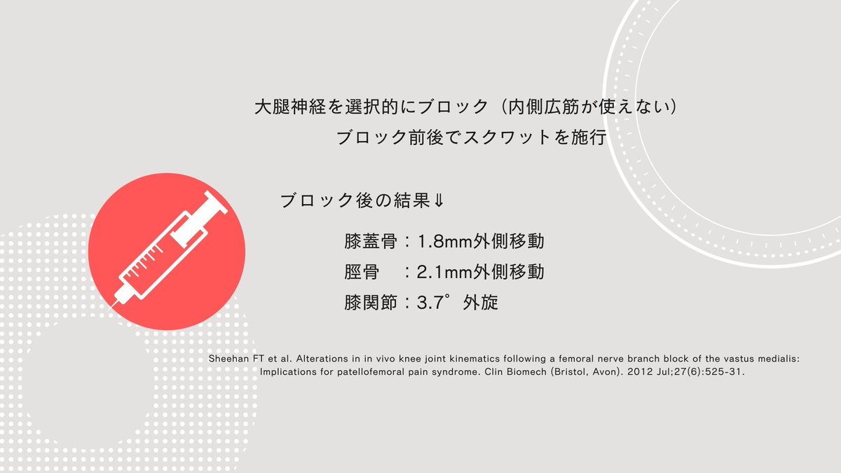 TakumiRodrigues's tweet photo. なぜ内側広筋が重要か？

1. 内側広筋斜頭が最終伸展域で働きやすいから
2. 膝蓋骨の外方変位、脛骨の外方傾斜・外旋を制動しているから
3. 反射性筋萎縮を起こしやすいから
4. 初期接地（IC）〜荷重応答期（LR）での衝撃緩衝作用を担っているから

これらを考えています。
https://t.co/h0JGdTd0JF https://t.co/aGb2Q3u5Cg