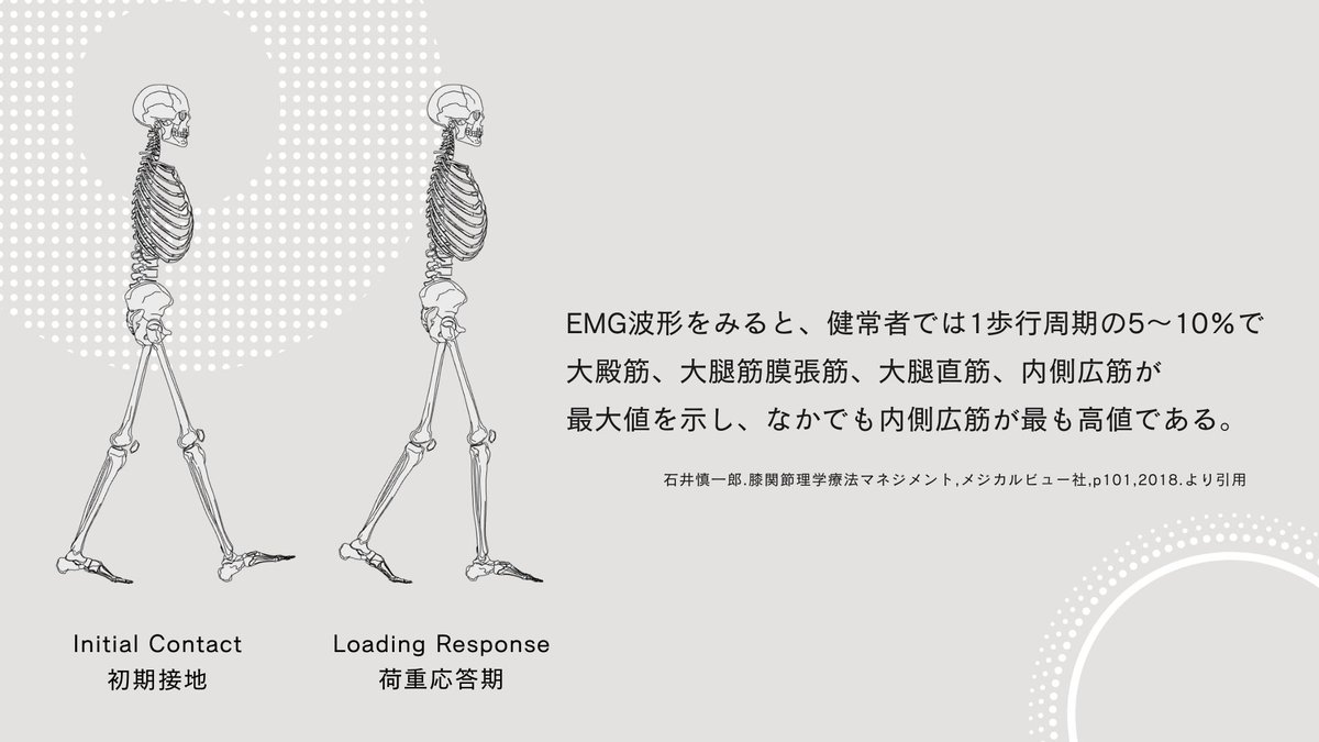TakumiRodrigues's tweet photo. なぜ内側広筋が重要か？

1. 内側広筋斜頭が最終伸展域で働きやすいから
2. 膝蓋骨の外方変位、脛骨の外方傾斜・外旋を制動しているから
3. 反射性筋萎縮を起こしやすいから
4. 初期接地（IC）〜荷重応答期（LR）での衝撃緩衝作用を担っているから

これらを考えています。
https://t.co/h0JGdTd0JF https://t.co/aGb2Q3u5Cg