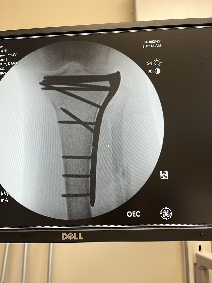 atx_tracy's tweet photo. Phase to recovery post being struck by a vehicle.  Transport to trauma center, surgery, rehab. https://t.co/ii9UbZM7yG
