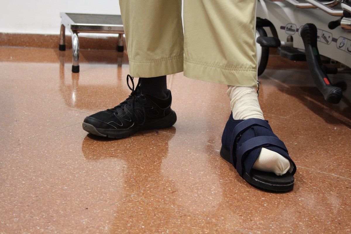 hospitaldelmar's tweet photo. L’@hospitaldelmar és pioner a l’Estat en aplicar un #protocol que redueix a la meitat l’ús de sabata rígida en el #postoperatori en la #cirurgia de #galindons, estalviant molèsties derivades de la seva utilització https://t.co/H7VdP4hQBC @EFASnews #ortopedia #traumatologia https://t.co/7ycp5YwLzK
