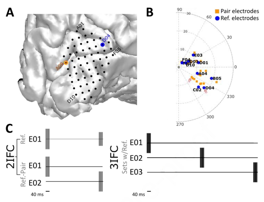 Sequence of visual cortex stimulation affects phosphene brightness in blind subjects https://t.co/beQE5FnXWv by @drpouratian et al. using the Orion I brain implant with 3 subjects; using 0.5 and 1.0 second inter-stimulus intervals