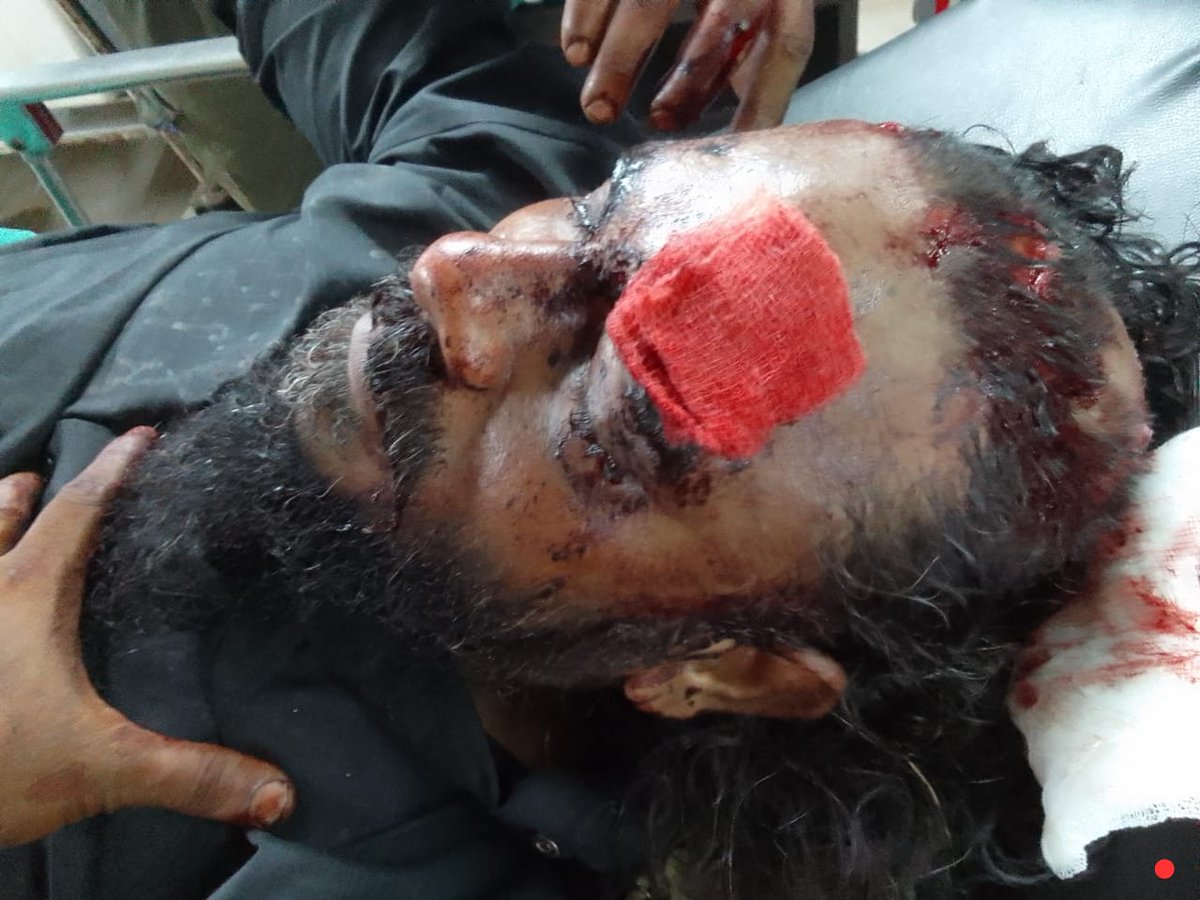 RSS ,BJP காரன் கழுத்தை வெட்டுவேன் என்று சொன்ன பாய் இன் நிலைமையை பாருங்கள்