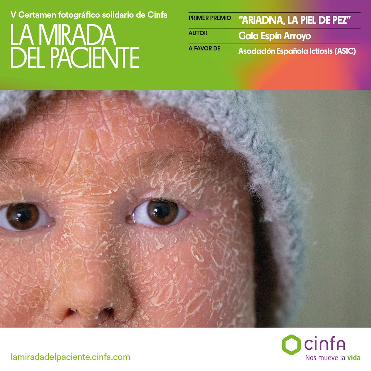 CinfaSalud's tweet photo. Enhorabuena a los premiados de la V Edición del Certamen Fotográfico CinfaSalud “La Mirada del paciente”: @galaeaphoto, Lidia Navarro y Santiago Sánchez. Sus fotos nos dan a conocer la situación de muchos pacientes y cómo se enfrentan a la enfermedad. https://t.co/GfXt7pP9hF https://t.co/Wo79vhExO1