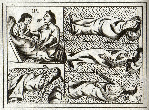 227Cabral's tweet photo. (5/6) They were also exposed to European diseases, such as smallpox, measles, tuberculosis, typhoid, dysentery, influenza, which many of them died from as their bodies had not ever been exposed to these illnesses, and had never developed a system to fight these diseases off https://t.co/98AHDJE2G7