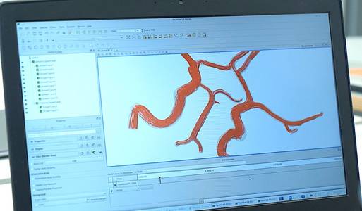 startupnds's tweet image. #StartupMap #Medical #Biomechanic
 
Softwarebasierte Risikobewertung zur Schlaganfallprävention!🩺

Das #Startup ELPIS Simulation aus #HannMünden hat es sich zum Ziel gemacht, das Leben von potenziellen Schlaganfallpatient*innen zu retten🧠💻

Infos unter👉bit.ly/3DE25tU