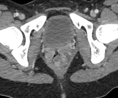 glitchpepe 🐸⚡ tweet media