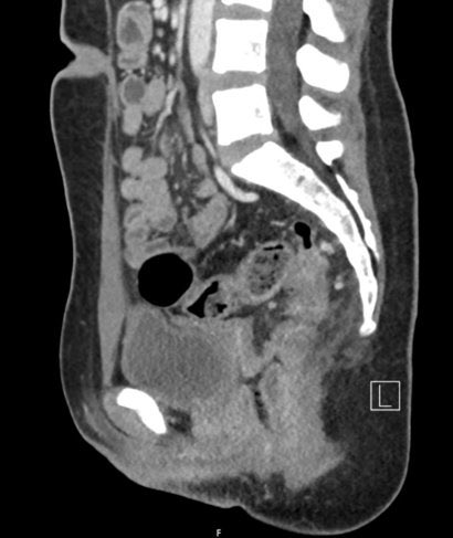 glitchpepe 🐸⚡ tweet media