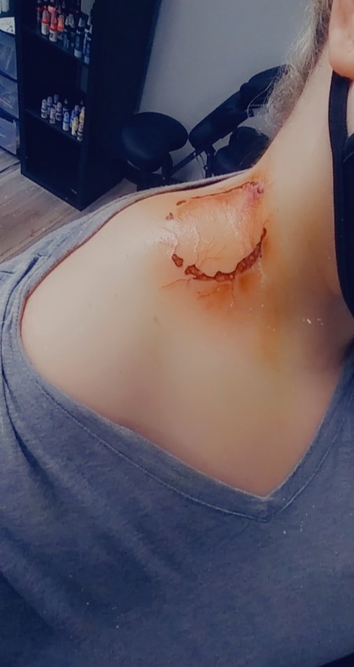 Jennacent's tweet photo. My absolutely favorite tattoo. I plan to add to it eventually. #zombiebite https://t.co/ispe0s8ytx