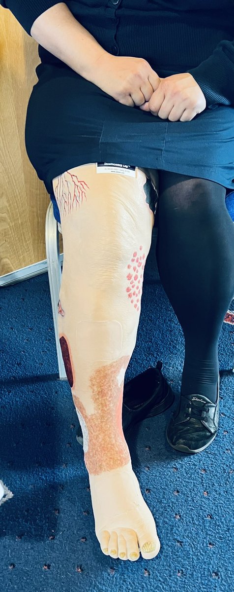ShropCommTVNs's tweet photo. Claire our TVN doesn’t appear to be doing too well with her leg… let’s see if we can get her assessed accurately and in the right treatment @ShropCommHealth https://t.co/hjXmIasVyF