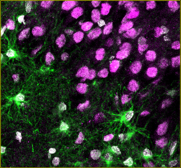 USC Stem Cell (@uscstemcell) on Twitter photo In a <a href="/NatureNeuro/">Nature Neuroscience</a> study, the Bonaguidi Lab and their collaborators present evidence that adults generate new brain cells—a process dramatically altered in patients with long-term #epilepsy. <a href="/USCStemCell/">USC Stem Cell</a> <a href="/KECKSchool_USC/">Keck School of Medicine of USC</a> <a href="/USCViterbi/">USC Viterbi School</a> <a href="/USCLeonardDavis/">USC Leonard Davis School of Gerontology</a> stemcell.keck.usc.edu/newborn-cells-… In a <a href="/NatureNeuro/">Nature Neuroscience</a> study, the Bonaguidi Lab and their collaborators present evidence that adults generate new brain cells—a process dramatically altered in patients with long-term #epilepsy. <a href="/USCStemCell/">USC Stem Cell</a> <a href="/KECKSchool_USC/">Keck School of Medicine of USC</a> <a href="/USCViterbi/">USC Viterbi School</a> <a href="/USCLeonardDavis/">USC Leonard Davis School of Gerontology</a> stemcell.keck.usc.edu/newborn-cells-…