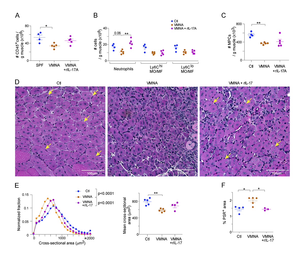 JExpMed's tweet photo. Mann, @bolahanna, Mathis @harvardmed et al report the accrual of IL-17–producing γδT cells shortly after acute injury of murine skeletal #muscle. This #microbiome-dependent population promotes muscle repair in an IL-17A– &amp; neutrophil-dependent manner. https://t.co/ujIRFE5chM https://t.co/yJnsIA6bra