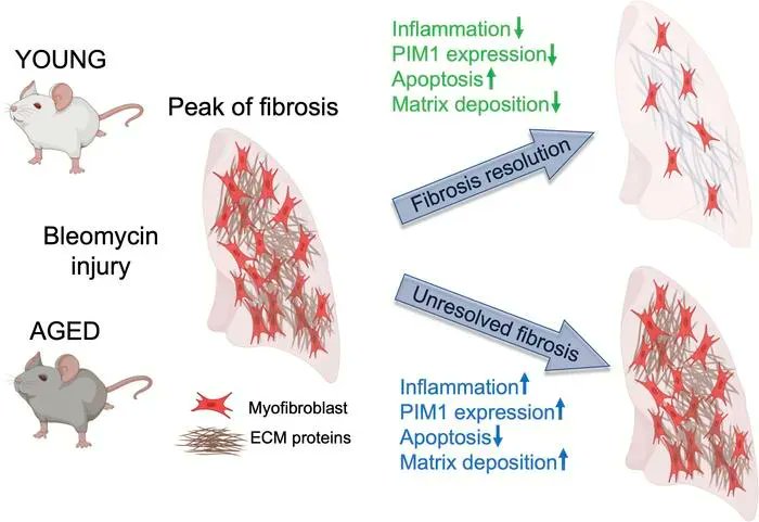 JCI insight (@jci_insight) on Twitter photo Transcriptional analysis of lung fibroblasts identifies PIM1 signaling as a driver of aging-associated persistent fibrosis: buff.ly/3wx1sAL
<a href="/BUPulmonary/">BU Pulmonary</a>
#Aging #Pulmonology Transcriptional analysis of lung fibroblasts identifies PIM1 signaling as a driver of aging-associated persistent fibrosis: buff.ly/3wx1sAL
<a href="/BUPulmonary/">BU Pulmonary</a>
#Aging #Pulmonology