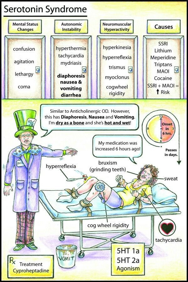 med_interesting's tweet photo. NMS🆚 Serotonin syndrome 🤩 https://t.co/ECvipeIfXz
