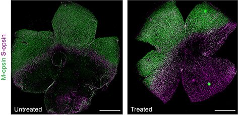 UCIMedSchool's tweet photo. A new UCI-led study indicates #BaseEditing may provide long-lasting retinal protection and prevent #vision deterioration in patients with inherited retinal degeneration. Read more: https://t.co/jZ5eBIgCj0 https://t.co/GPSQD0tCIX