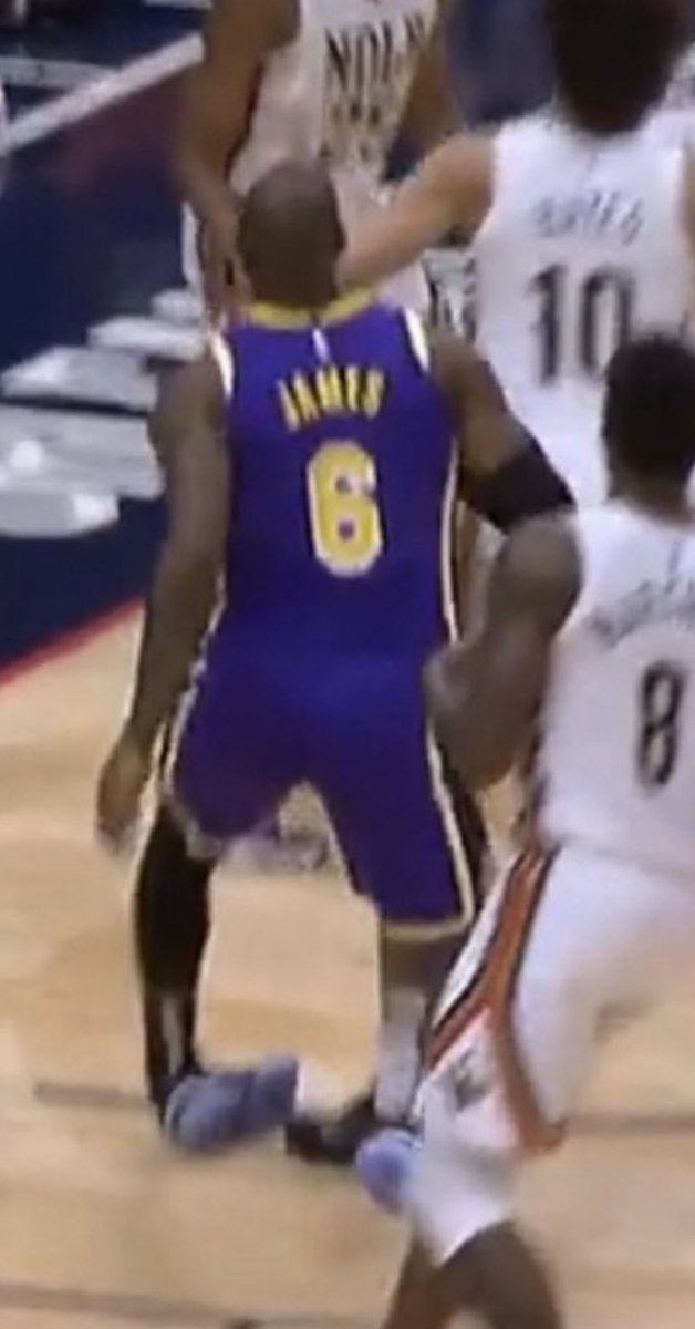 casualtakeking's tweet photo. Lebron James is the only player in NBA history who can be slandered for not playing after his ankle looked like this with all due respect https://t.co/XQbMzwW0xz