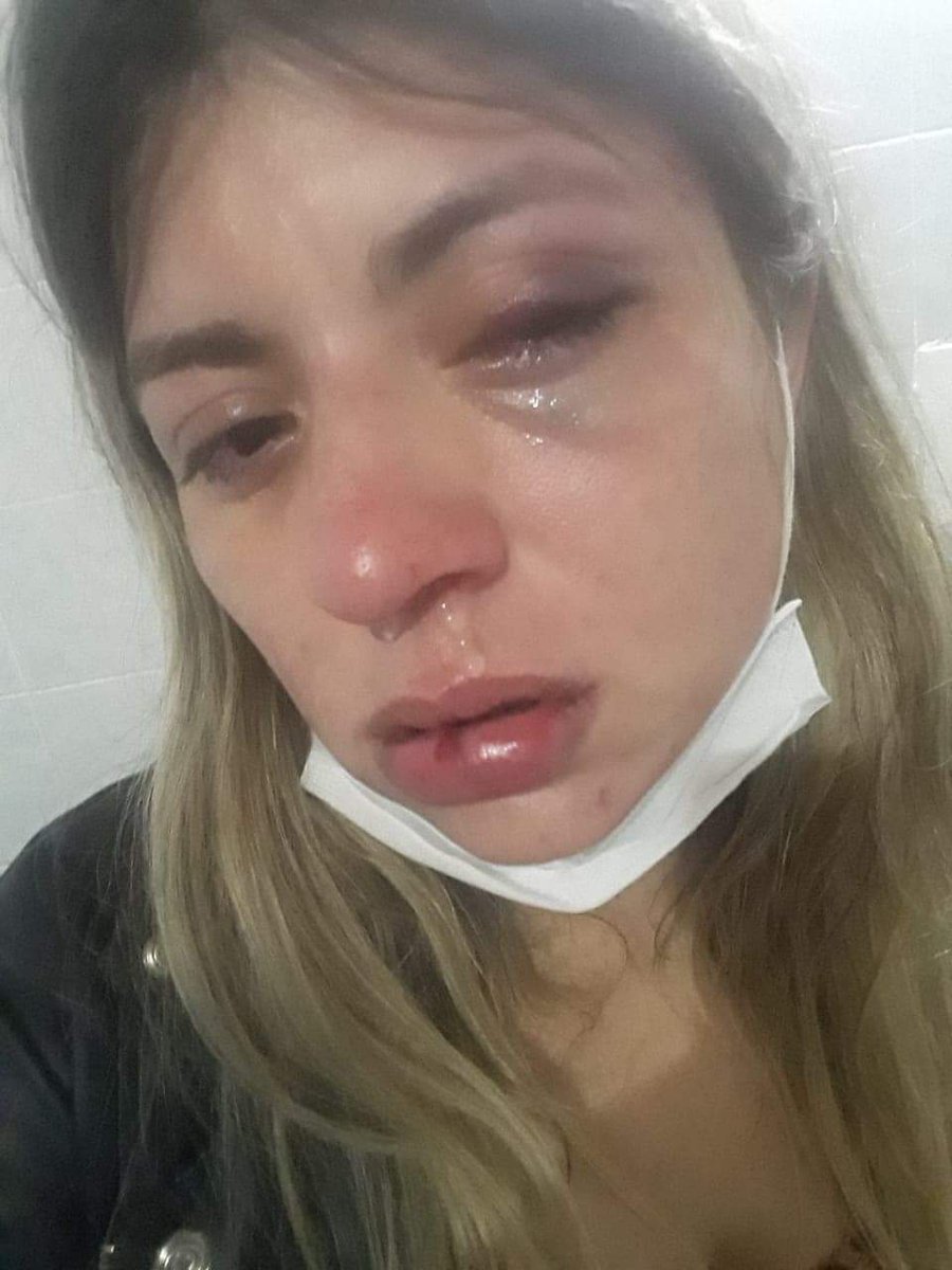 ivanzukich9's tweet photo. Gente solidaria y comprensiva de Twitter, por favor RT hasta llegar a las autoridades correspondientes.
Le pasó a la hermana de un amigo, y éste impresentable "abogado" merece CÁRCEL. Encima ya saben de que partido es...
#NiUnaMenos @MinPublicoPy @policia_py @minmujerpy https://t.co/PWBsMBaez0
