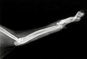 goforbrookie's tweet photo. 😩 I stg my babies are the wildest babies to have ever wild. Also fyi if you don’t have pet insurance apparently you can’t get it retroactively. So…this is fun! If anyone has ever had a kitty with a bad fracture and have tips pls lmk. I’m really beside myself rn. https://t.co/89WHHqijE3