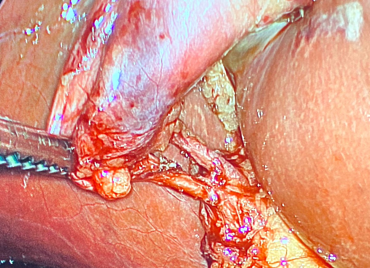 Ian S Soriano 🇵🇭 tweet media