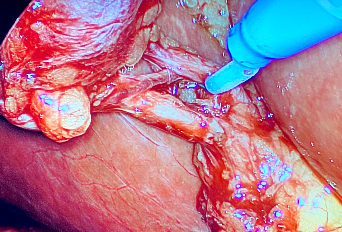 Ian S Soriano 🇵🇭 tweet media