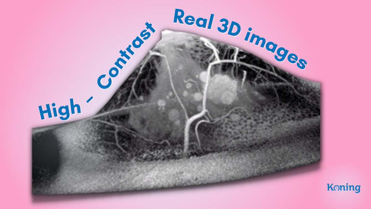 KoningCorp's tweet image. As the winner of multiple awards including the 2016 Frost and Sullivan New Innovation Award in Breast Imaging, and as holder of over 80 patents globally, Koning has developed technology to bring a better breast imaging solution to women around the world.  #KBCT #Koning