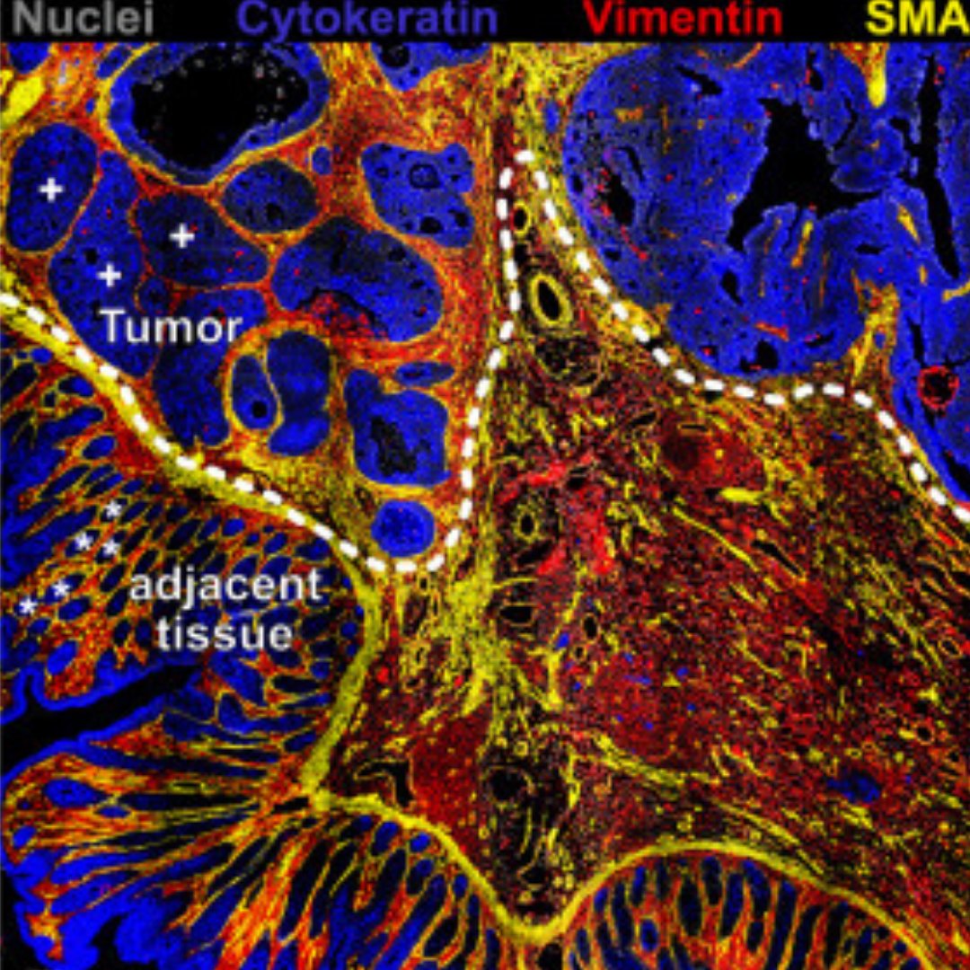 CanopyBio's tweet photo. This week on #CreatedWithCanopy, take a look at a multiplexed staining of FFPE colon tissue collected by Sebastian Jarosch for a publication in Cell Reports using @CanopyBio's ChipCytometry platform.
Learn about the new ChipCytometry instrument CellScape: https://t.co/LKqIeD7YgI https://t.co/0km1RqaEUv