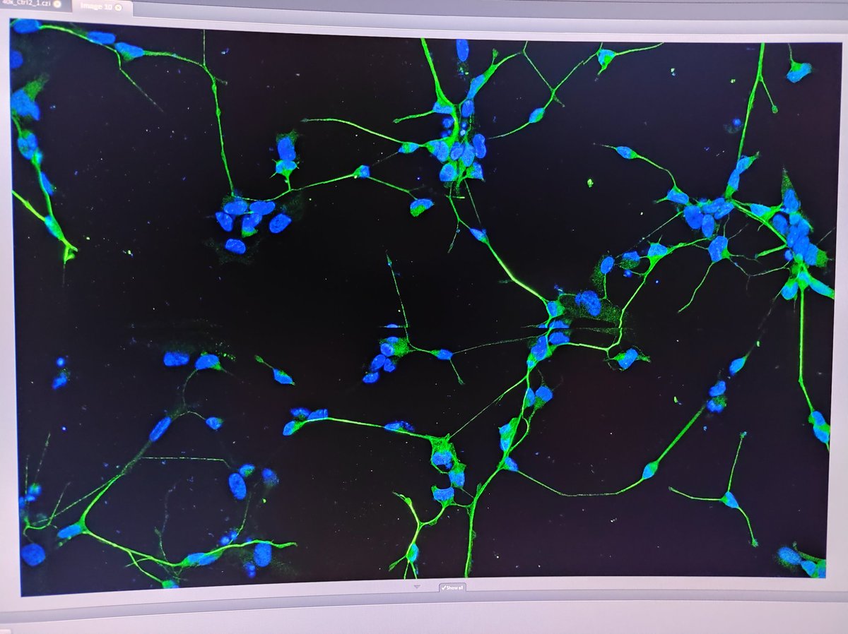 sahermar_'s tweet photo. Mi hilo de queja sobre #Ciencia está ilustrado con una foto del confo de unas neuronas, que han tardado en ser neuronas, pero ahí están, expresando marcadores de neurona adulta 🧠 😍. Volver a ESpain con una talento de la CAM ha sido un suicidio científico. Aquí os cuento xq ⬇️👀 https://t.co/NgpQahaVah