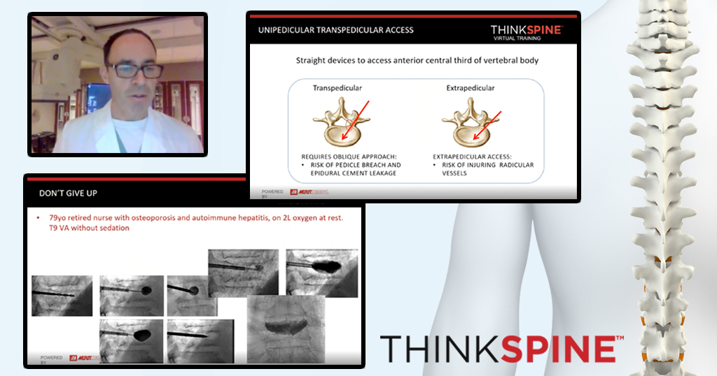 MeritMedical's tweet photo. Valuable Think Spine™ webinar discussing importance of steerable technology in treatment of VCF and spinal metastatic disease. Thank you, Dr. Dunleavy, for sharing your knowledge with fellow physicians.

Missed a course? Explore our on-demand library ➡️ https://t.co/IG9FlIG21v https://t.co/N9D5JF3egJ