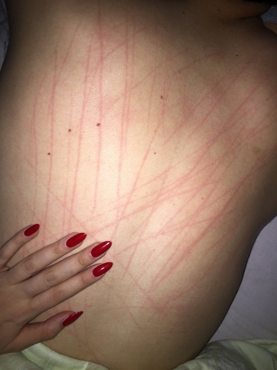 Who scratched his back?